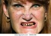 mature_woman_whose_teeth_ground_down_preparation_dental_cg3p6830396c.jpg