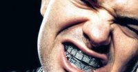 Paul-Wall-Mouth-Teeth-Grillz_grande.jpg