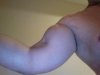 tornbicep.jpg