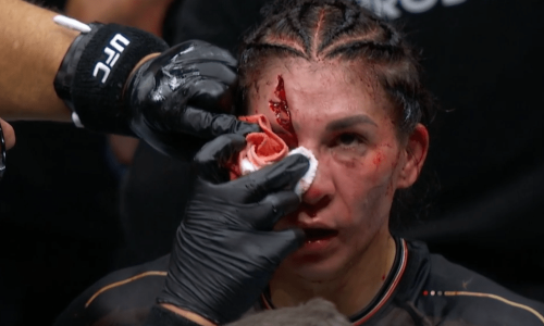 irene-aldana-ufc-306.png