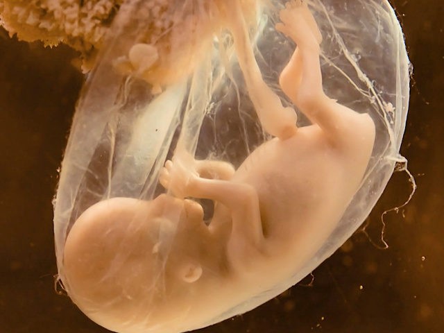 Fetus-in-Utero-640x480.jpg