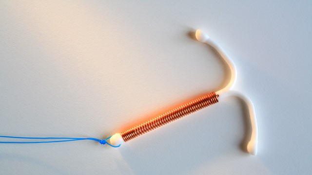 nc_iud_contraceptive_nt_120508_wg.jpg