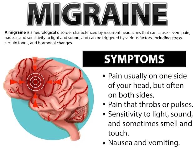 Symptoms%20of%20migraine.jpg