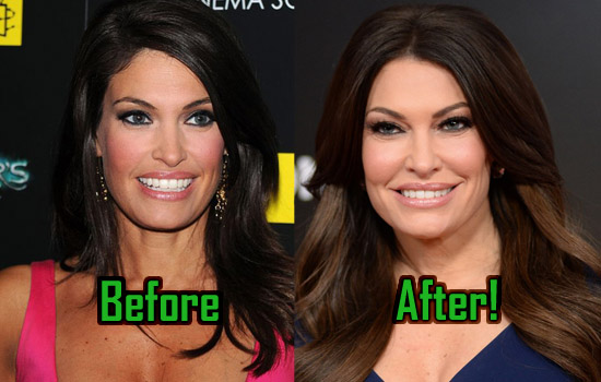 Kimberly-Guilfoyle-Plastic-Surgery.jpg